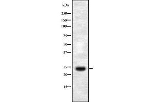 Western blot analysis SEI-1 using HepG2 whole cell lysates (SERTAD1 抗体  (Internal Region))
