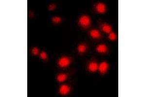 Immunofluorescent analysis of Cyclin A1/2 staining in NIH3T3 cells. (Cyclin-A1-2 抗体  (Center))