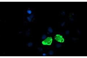 Anti-ENPEP mouse monoclonal antibody (ABIN2455323) immunofluorescent staining of COS7 cells transiently transfected by pCMV6-ENTRY ENPEP (RC210521). (ENPEP 抗体)