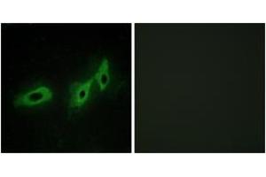 Immunofluorescence analysis of HeLa cells, using TRI18 Antibody. (MID1 抗体  (AA 71-120))