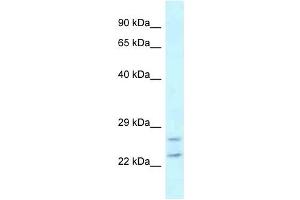 Western Blot showing RAB2A antibody used at a concentration of 1 ug/ml against MDA-MB-435S Cell Lysate (RAB2A 抗体  (C-Term))