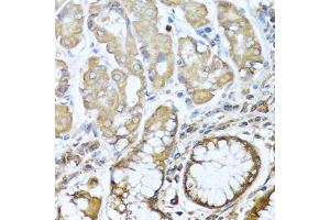 Immunohistochemistry of paraffin-embedded human stomach using NRG4 antibody. (Neuregulin 4 抗体)