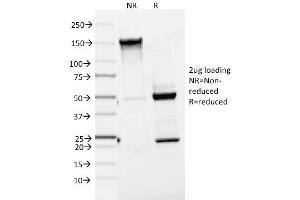 SDS-PAGE Analysis Purified MART-1 / Melan-A Mouse Monoclonal Antibody (A103). (MLANA 抗体)