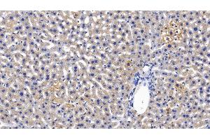 Detection of MBL in Mouse Liver Tissue using Polyclonal Antibody to Mannose Binding Lectin (MBL) (MBL2 抗体  (AA 129-244))