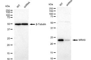 Western blotting analysis using MRAS antibody (ABIN7799496).