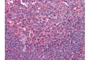 Immunohistochemical analysis of paraffin-embedded human Tonsil tissues using anti-CD80 mAb (CD80 抗体)