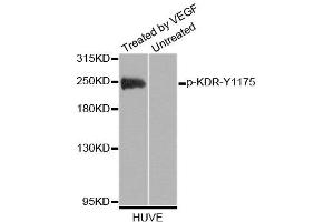 Western blot analysis of extracts of HUVE cells, using Phospho-KDR-Y1175 antibody (ABIN2988109). (VEGFR2/CD309 抗体  (pTyr1175))