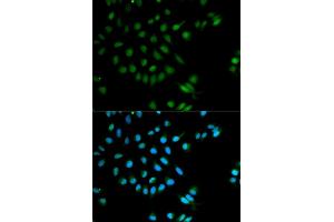 Immunofluorescence analysis of MCF-7 cells using XRCC2 antibody (ABIN5970910). (XRCC2 抗体)