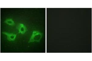 Immunofluorescence analysis of HeLa cells, using CKI-alpha Antibody. (CSNK1A1 抗体  (AA 126-175))