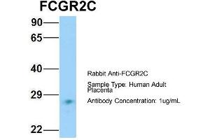 Host: Rabbit Target Name: FCGR2C Sample Type: Human Adult Placenta Antibody Dilution: 1. (FCGR2C 抗体  (N-Term))