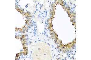 Immunohistochemistry of paraffin-embedded mouse lung using NIN antibody (ABIN6129422, ABIN6144630, ABIN6144632 and ABIN6224239) at dilution of 1:100 (40x lens). (Ninein 抗体  (AA 1-287))