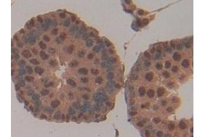 Detection of CD2AP in Rat Testis Tissue using Polyclonal Antibody to CD2 Associated Protein (CD2AP)