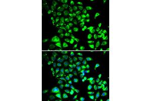 Immunofluorescence analysis of U20S cell using SSBP1 antibody. (SSBP1 抗体)