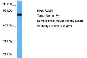 Host: Rabbit Target Name: FYN Sample Tissue: Mouse Kidney Antibody Dilution: 1ug/ml (FYN 抗体  (Middle Region))