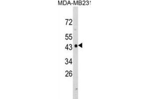 Western Blotting (WB) image for anti-N-Myc Downstream Regulated 1 (NDRG1) antibody (ABIN3002891) (NDRG1 抗体)