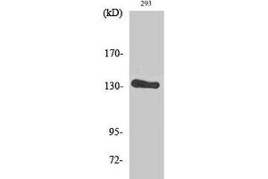 Western Blot analysis of 293 cells using ERBB2 Polyclonal Antibody at dilution of 1:2000. (ErbB2/Her2 抗体)