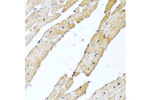 Immunohistochemistry of paraffin-embedded rat heart using CALCB antibody at dilution of 1:100 (40x lens).
