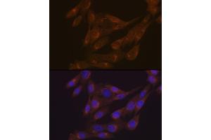 Immunofluorescence analysis of NIH-3T3 cells using PIST/GOPC Rabbit mAb (ABIN1678809, ABIN1678808, ABIN7101325 and ABIN7101326) at dilution of 1:100 (40x lens). (GOPC 抗体)