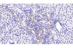 Detection of MAPK9 in Human Kidney Tissue using Polyclonal Antibody to Mitogen Activated Protein Kinase 9 (MAPK9) (JNK2 抗体  (AA 130-387))