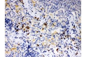 IHC testing of FFPE rat spleen with ATG14L antibody. (ATG14 抗体)