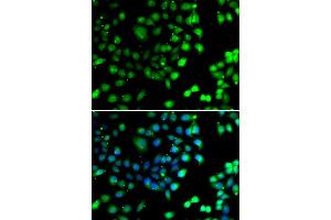 Immunofluorescence analysis of A549 cell using NTMT1 antibody. (METTL11A 抗体)