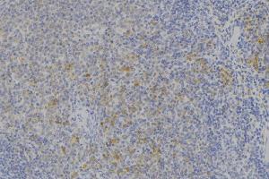 ABIN6273665 at 1/100 staining Human lymph node tissue by IHC-P. (IFNAR2 抗体  (C-Term))