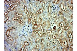 Paraformaldehyde-fixed, paraffin embedded Rat kidney; Antigen retrieval by boiling in sodium citrate buffer (pH6. (GPD2 抗体  (AA 165-270))
