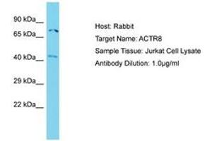 Image no. 1 for anti-ARP8 Actin-Related Protein 8 Homolog (ACTR8) (N-Term) antibody (ABIN6750738) (ACTR8 抗体  (N-Term))