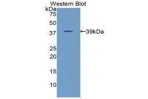Western Blotting (WB) image for anti-Calcitonin (Calca) (AA 25-85) antibody (ABIN1172938) (Calcitonin 抗体  (AA 25-85))