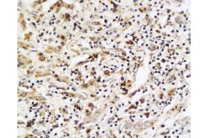 Immunohistochemistry (Paraffin-embedded Sections) (IHC (p)) image for anti-Placenta Growth Factor (PGF) (AA 166-221) antibody (ABIN727235) (PLGF 抗体  (AA 166-221))