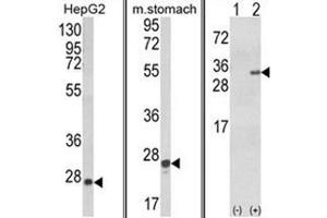 (LEFT) Western blot analysis of GSTA1 Antibody in HepG2 cell line lysates (35ug/lane). (GSTA1 抗体)