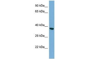 Host: Rabbit Target Name: TWF2 Antibody Dilution: 1. (TWF2 抗体  (N-Term))
