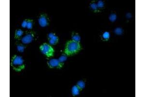 Anti-CALCOCO2 mouse monoclonal antibody (ABIN2453949) immunofluorescent staining of COS7 cells transiently transfected by pCMV6-ENTRY CALCOCO2 (RC203843). (CALCOCO2 抗体)