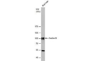 WB Image Factor B antibody [N2C2], Internal detects Factor B protein by western blot analysis. (Complement Factor B 抗体)