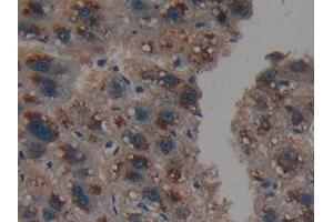 Detection of PSMD9 in Human Liver Tissue using Polyclonal Antibody to Proteasome 26S Subunit, Non ATPase 9 (PSMD9) (Proteasome 26S Subunit, Non ATPase 9 (AA 2-223) 抗体)
