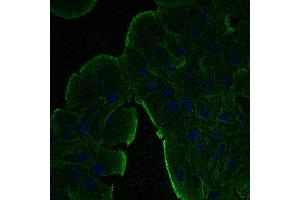 Immunofluorescence - anti-beta-Actin Ab at 1/100 dilution in NHl/3T3 cells, cells were fixed with methanol and permeabilized with 0. (beta Actin 抗体  (N-Term))