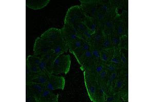 Immunofluorescence - anti-beta-Actin Ab at 1/100 dilution in NHl/3T3 cells, cells were fixed with methanol and permeabilized with 0.