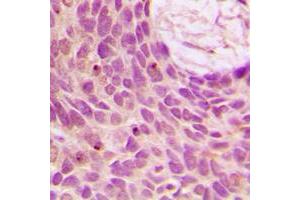 Immunohistochemistry (IHC) image for anti-SUMO1/sentrin Specific Peptidase 1 (SENP1) (N-Term) antibody (ABIN7298102)