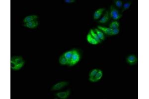 Immunofluorescence staining of HepG2 cells with ABIN7151234 at 1:66, counter-stained with DAPI. (TRAF7 抗体  (AA 1-90))
