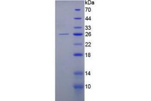 SDS-PAGE analysis of Human Keratin 8 Protein. (KRT8 蛋白)