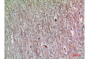 Immunohistochemistry (IHC) image for anti-ADAM Metallopeptidase with thrombospondin Type 1 Motif, 18 (ADAMTS18) (AA 1030-1110) antibody (ABIN7184547)