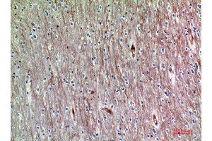 Immunohistochemical analysis of paraffin-embedded human-brain, antibody was diluted at 1:200 (ADAMTS18 抗体  (AA 1030-1110))