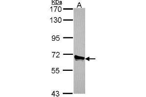 WB Image Sample (30 ug of whole cell lysate) A: A549 7. (ACOX3 抗体  (C-Term))