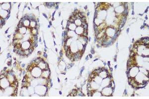 Immunohistochemistry of paraffin-embedded Human colon using ECH1 Polyclonal Antibody at dilution of 1:150 (40x lens). (ECH1 抗体)