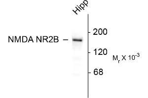 Western blots of 10 ug of rat hippocampal (Hipp) lysate showing specific immunolabeling of the ~180k NR2B subunit of the NMDA receptor. (GRIN2B 抗体  (C-Term))