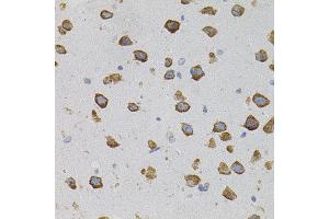 Immunohistochemistry of paraffin-embedded mouse brain using VEGFC antibody. (VEGFC 抗体)