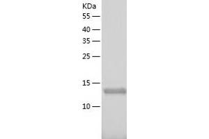 Western Blotting (WB) image for XiAP Associated Factor 1 (XAF1) (AA 1-125) protein (His tag) (ABIN7125752) (XAF1 Protein (AA 1-125) (His tag))