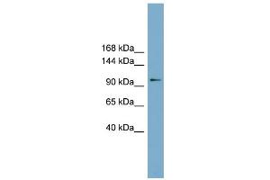 WB Suggested Anti-FTSJD1 Antibody Titration: 0. (CMTR2 抗体  (Middle Region))
