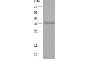 FANK1 Protein (AA 1-345) (His tag)
