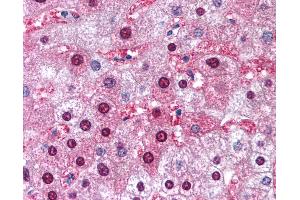 Anti-GSTM1 antibody IHC of human liver.